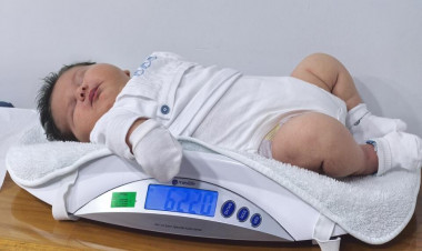 6 kilodan çox doğulan körpə gündəm oldu - FOTO