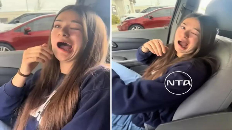 Qızın ağzı qəfil əyildi - ağlasığmaz səbəb