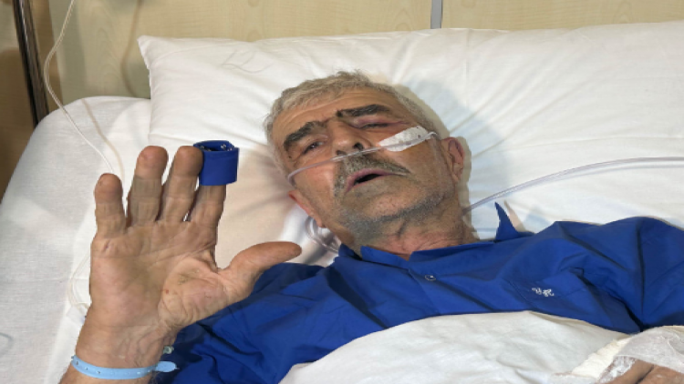 Yaralıların çoxu 1-2 gün sonra evə buraxılacaq - FOTO