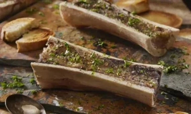 Sümük iliyi bilindiyi qədər faydalıdırmı? - Mütəxəssisdən açıqlama