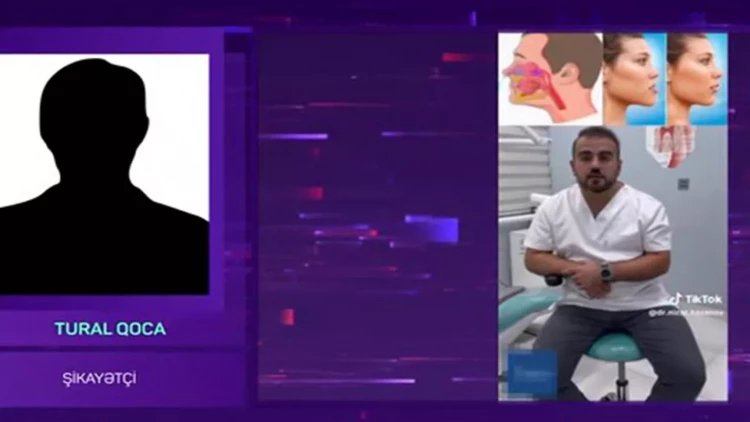 500 manat ziyana düşdü, az qaldı ölsün - “TikTok Stomatoloqu” barəsində AĞIR İDDİA - VİDEO
