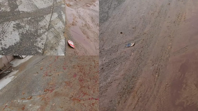 Yasamalda küçəni qan bürüyüb - FOTOlar