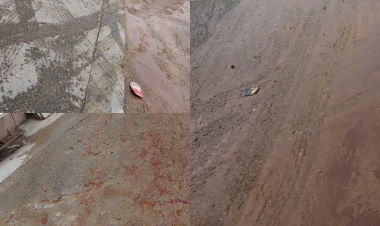 Yasamalda küçəni qan bürüyüb - FOTOlar