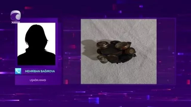 Batareya və maqnit qırıntıları udan 10 yaşlı uşağın anası DANIŞDI - VİDEO