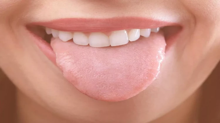 Dilin rənginə baxıb xəstəliyi 