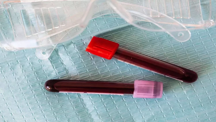 Tibbdə inqilabi yenilik - Hər orqanın yaşını ayrıca yoxlamaq mümkün oldu