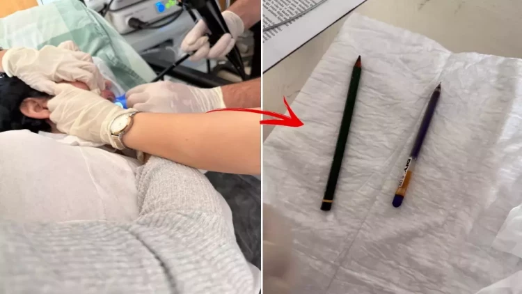 22 yaşlı qadının mədəsindən qələm çıxdı - FOTO