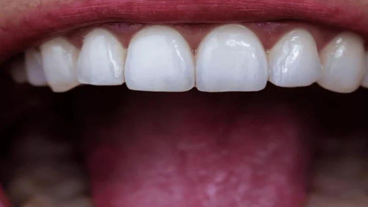 Diş fırçalamamaqla infarktın əlaqəsi açıqlandı