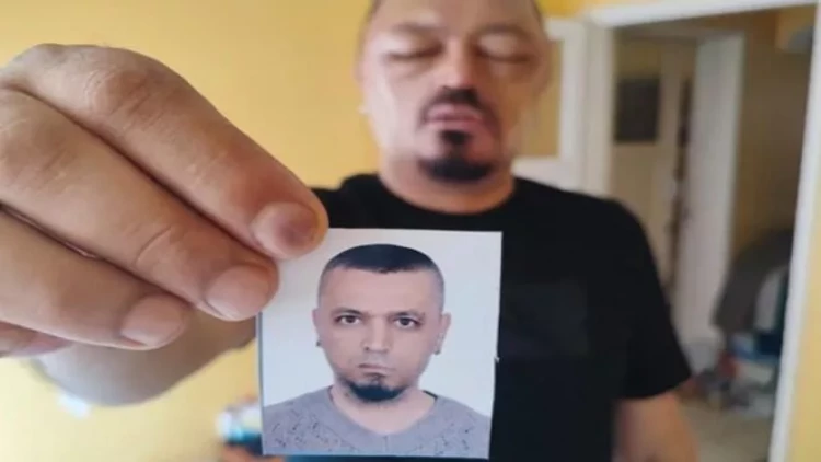 İnternetdən aldığı şampun həyatını kabusa çevirdi - FOTO