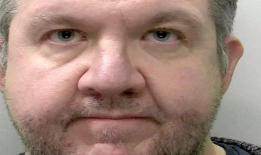 Cərrah sığortadan pul almaq üçün öz ayaqlarını amputasiya etdi - FOTO