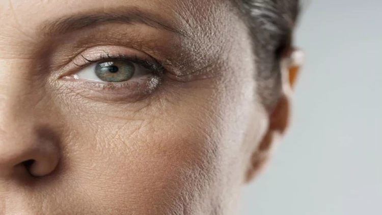 Üzün vaxtından tez qırışmasının 3 əsas səbəbi - Açıqlama