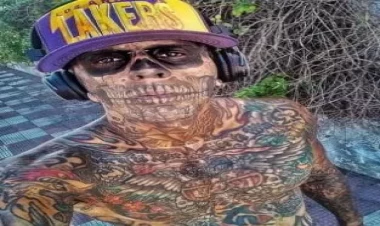 Bədəni 95 faiz döymə idi - yeni FOTOları şoka saldı