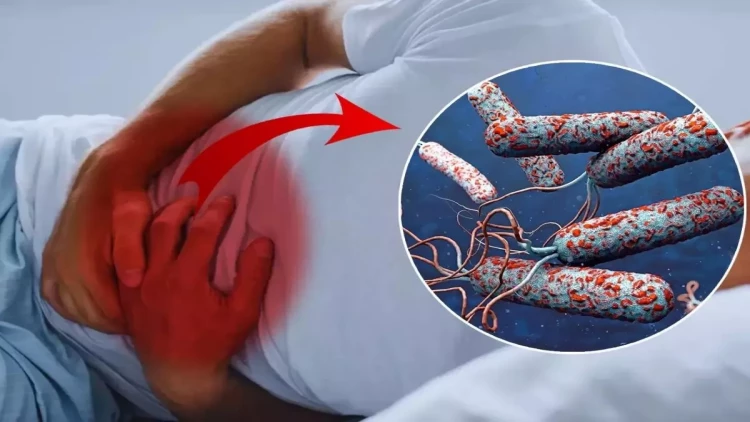 31 ölkədə xolera təbili – Ölənlərin sayı sürətlə artır