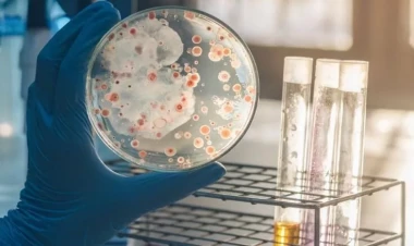 Bu məlhəmlə yaralarınız sağalacaq