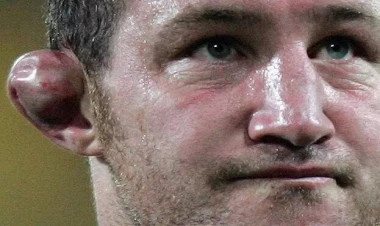 Azərbaycanda pulla qulaq SINDIRMAQ niyə trend oldu? - FOTO