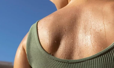 Çox tərləyən qadınların nəzərinə - Ginekoloqdan xəbərdarlıq