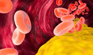 Adi ədviyyat xolesterini azaldır və ürək sağlamlığını dəstəkləyir