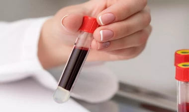 Hindistanda tibbi sensasiya: Yeni qan qrupu tapıldı