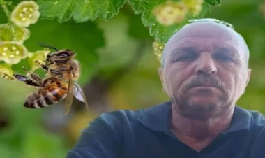 Arı sancan kişi öldü
