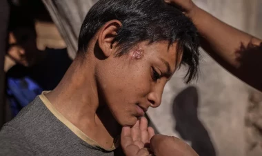 Alimlər vəba epidemiyalarının sirrini açdı