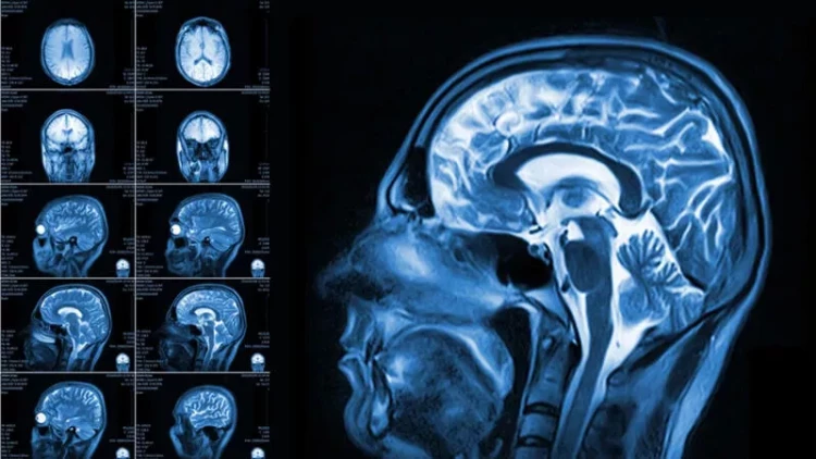 Beynimiz haqqında yeni kəşf: Gördüyünə deyil, gözlədiyinə inanır