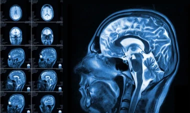 Beynimiz haqqında yeni kəşf: Gördüyünə deyil, gözlədiyinə inanır