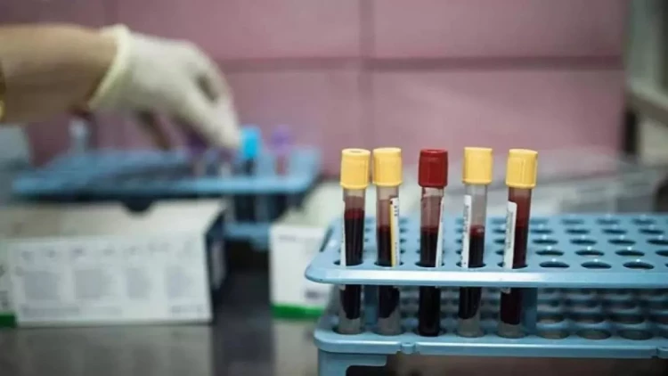 Xərçəngin bu növü Y nəslinin yeni kabusuna çevrilib