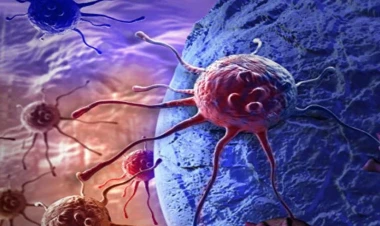 Xərçəng xəstələrinin sayı niyə çoxalır?