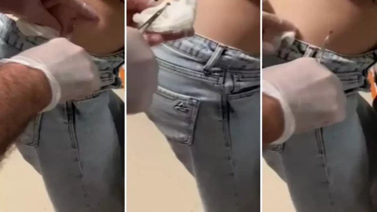 Gənc qadının kənd istirahəti kabusa çevrildi – Kürəyində görün nə tapdılar