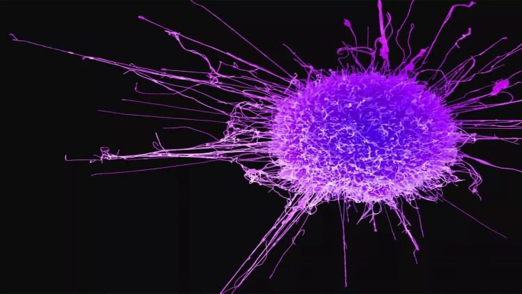 Bu qablar xərçəng yaradır - XƏBƏRDARLIQ