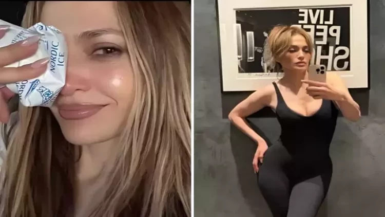 Cennifer məşq zamanı yaralandı - FOTO