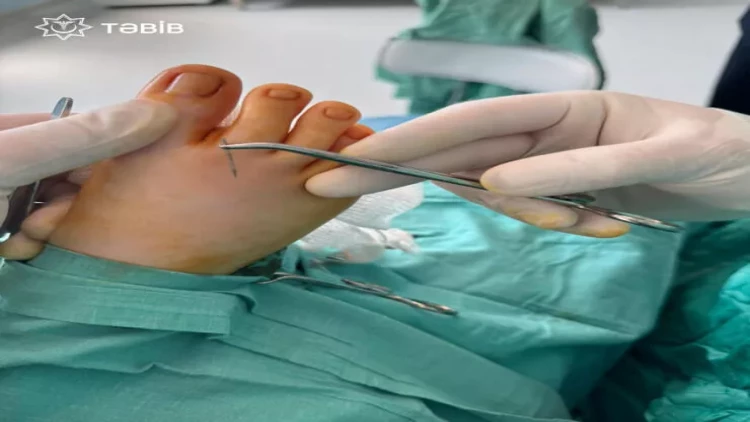 Bakıda uşağın ayağındakı iynə 14 gün sonra tapıldı - FOTO