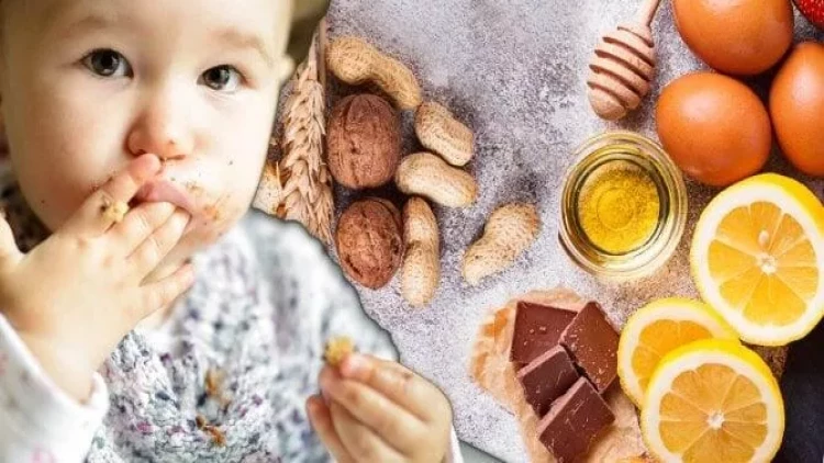 Uşağınızda qaşınma, qızartı, səpki varsa, bu qidaları verməyin