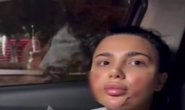 Qadına hücum etdiyi deyilən sabiq məmur nəvəsi saxlanıldı - yenilənib - VİDEO