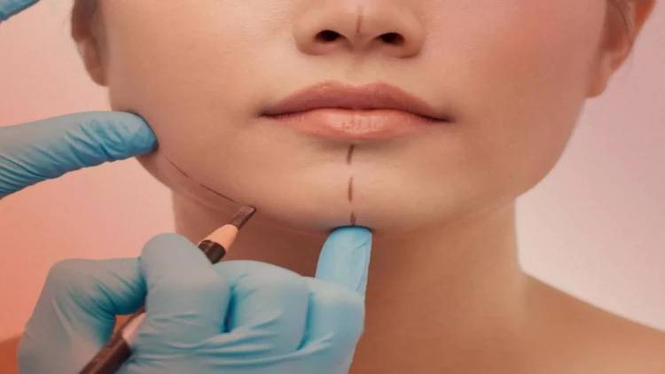 Siyahıda olmayan plastik cərrahlar məhkəməyə üz tutacaq?