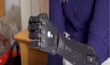 19 yaşlı “Instagram” fenomeni protez qolu ilə qeyri-adi bacarıqlar nümayiş etdirir