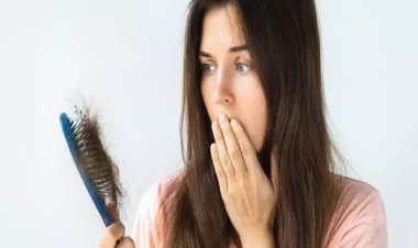 Saçı tökülən qadınlar mütləq OXUSUN