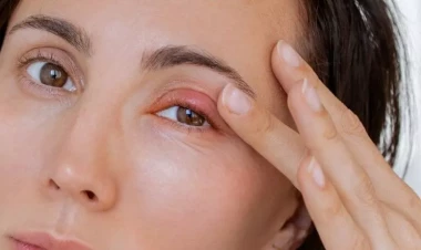 Qızarmış göz qapaqları bu xəstəliyin əlamətidir - DİQQƏT