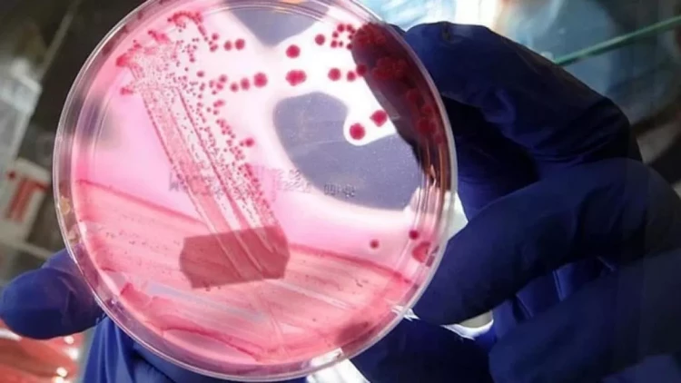 Kişilərdə ən çox rast gəlinən ikinci xərçəng növü hansıdır?