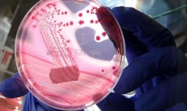 Kişilərdə ən çox rast gəlinən ikinci xərçəng növü hansıdır?