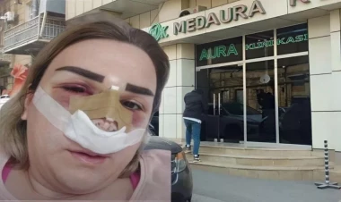 Növbəti estetik əməliyyat qurbanı 