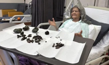 92 yaşlı qadının mədə və bağırsağından çıxanlar hər kəsi şoka saldı