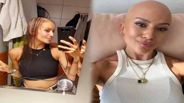 Əməliyyatla sinəsini böyütdü, keçəl qaldı - FOTO