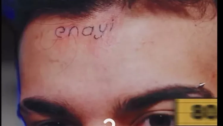 80 minə görə alnına döymə etdirib bu sözü yazdırdı - FOTO