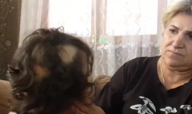 5 yaşlı uşaq həkimin müalicəsindən sonra keçəlləşib? - DETALLAR - VİDEO