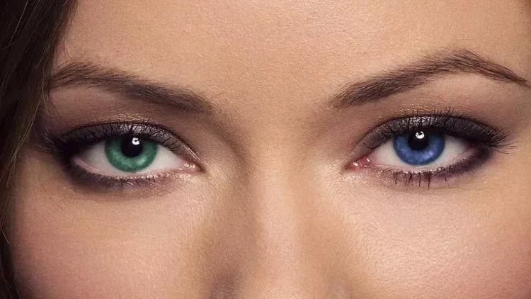 Göz rənginin dəyişdirilməsi əməliyyatı qadağan dilməlidir, insanlar kor olur