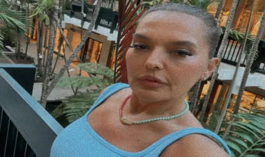 Gülşəni qınamışdı, ondan daha açıq geyimdə səhnəyə çıxdı - FOTO