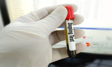 Nigeriyalı boksçu diskvalifikasiya olunub