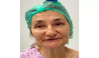 75 yaşlı qadının estetik əməliyyatla dəyişimi gündəm oldu - VİDEO