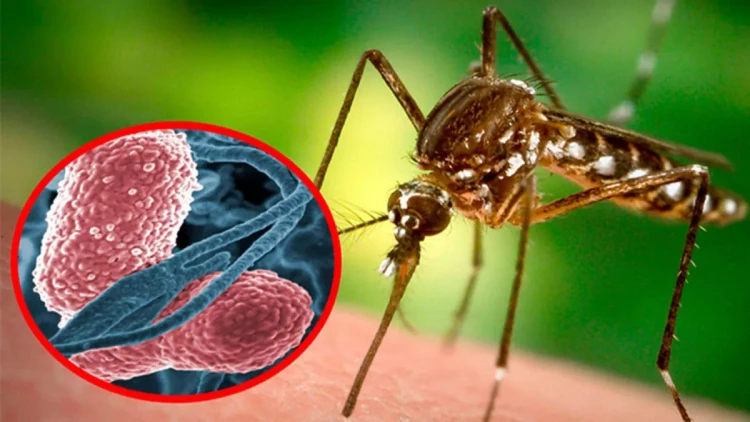 Bu xəstəlik İsraildə 11 can aldı